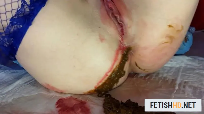 Anna Coprofield - Shit and Blood Vol.5 Speculum Part 1 (Scat) [FullHD 1080p / 1.58 GB]