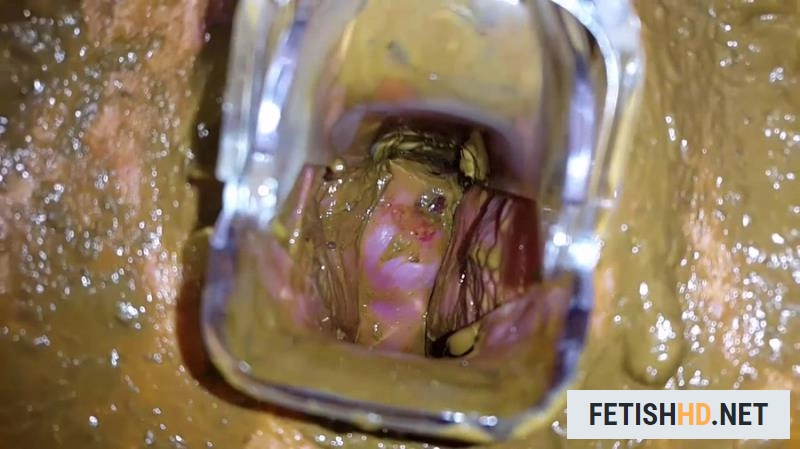 Anna Coprofield - Tampon, Speculum Filled Pussy Part 2 (Scat) [FullHD 1080p / 1.60 GB]